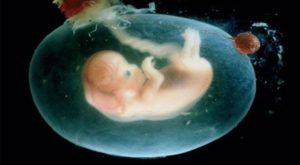 Фото. Близнец-паразит внутри младенца обречён на гибель